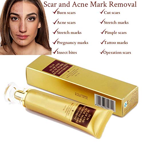SkinRosa Crema para eliminar eficazmente el acné y las cicatrices como quemaduras, cortes, marcas de estiramiento de embarazo, manchas de acné, Elimina las cicatrices nuevas y antiguas